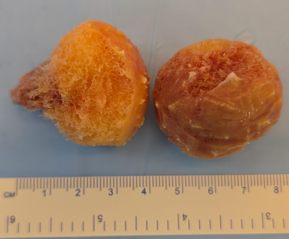 Femoral Head - FH1126