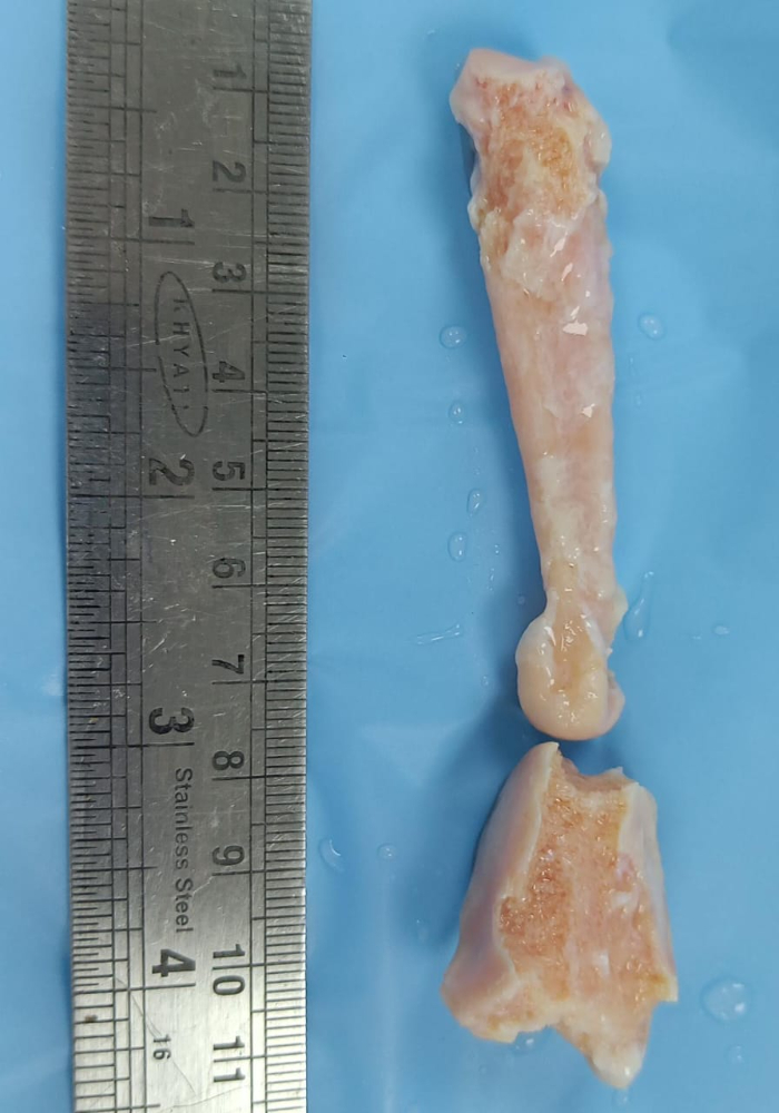 Metatarsal - MC124
