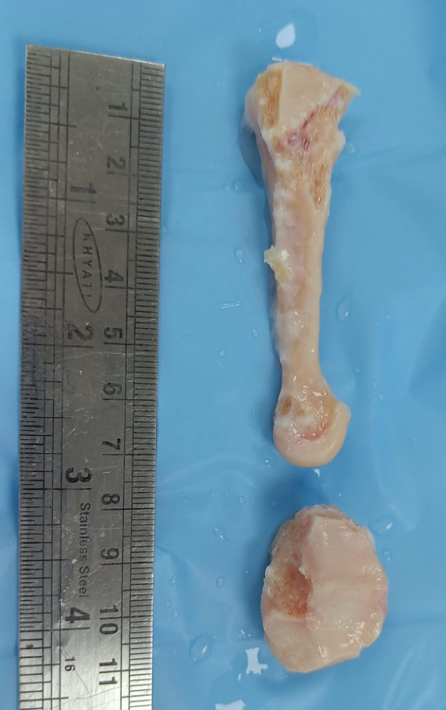 Metatarsal - MC125