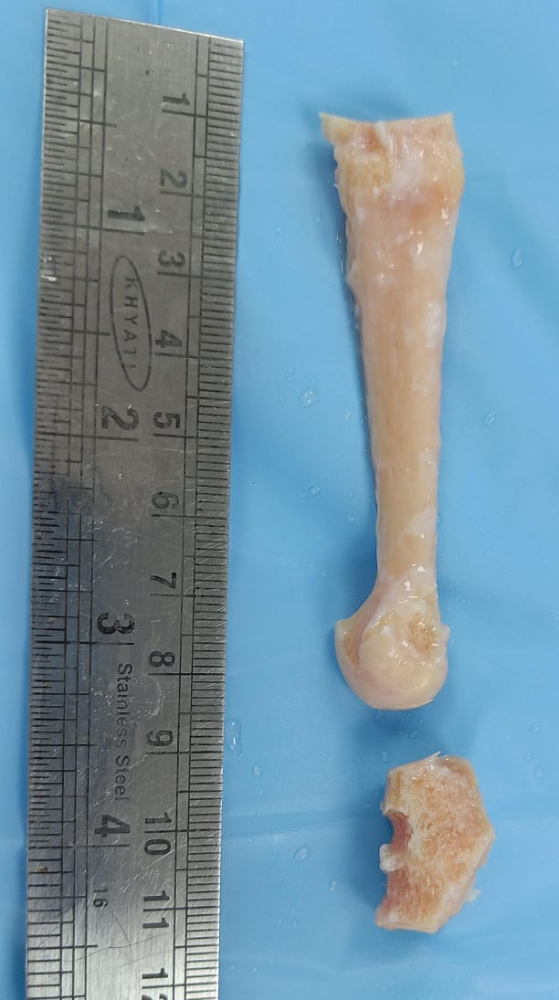 Metatarsal - MC126