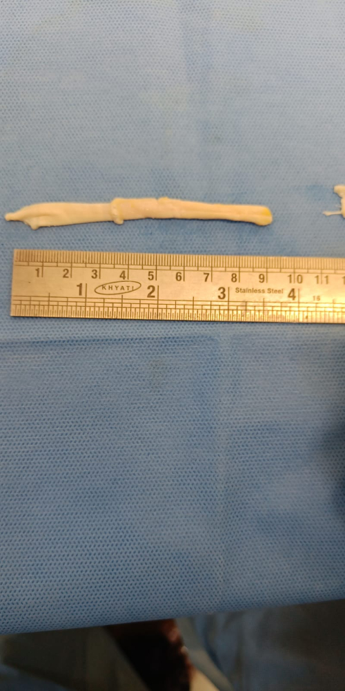 Tendon Small - TN(S)002
