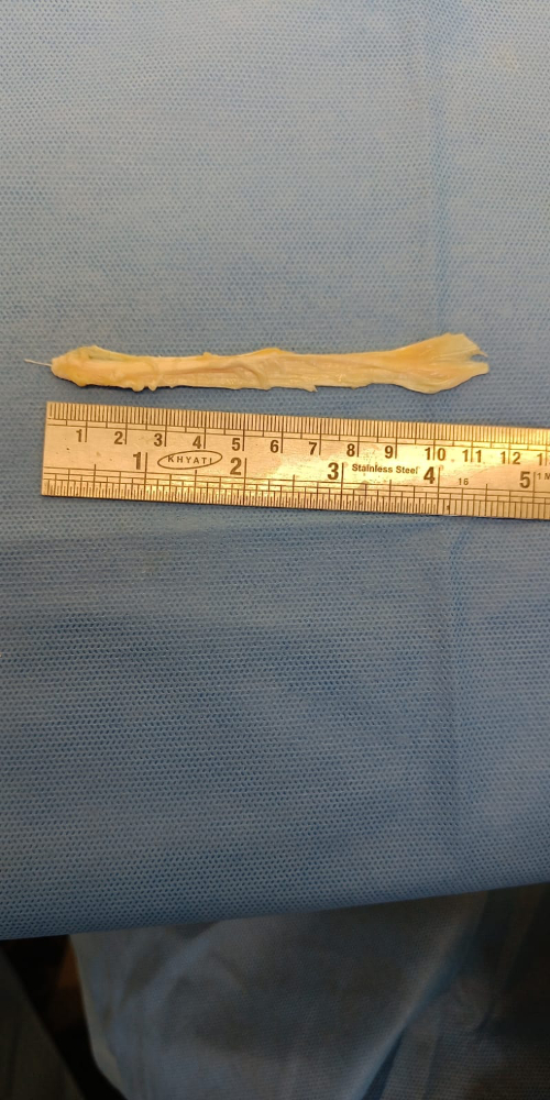 Tendon Small - TN(S)004