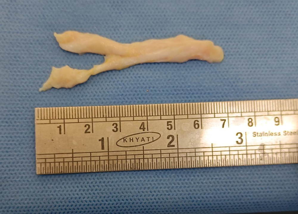 Tendon Small - TN(S)005
