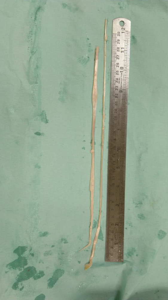 Tendon - TN228