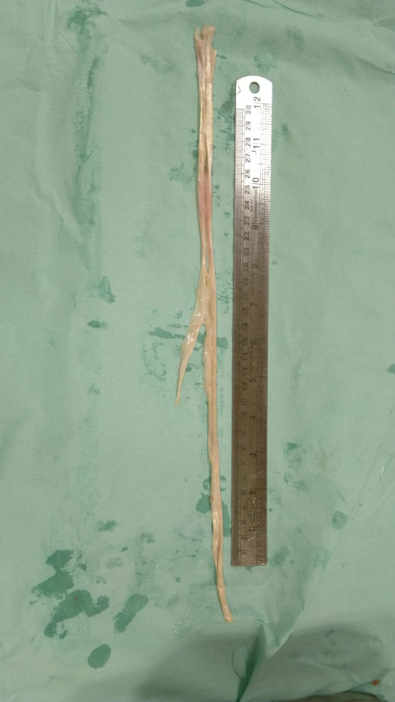 Tendon - TN229