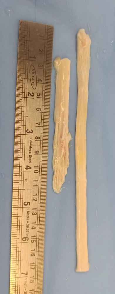 Tendon - TN253