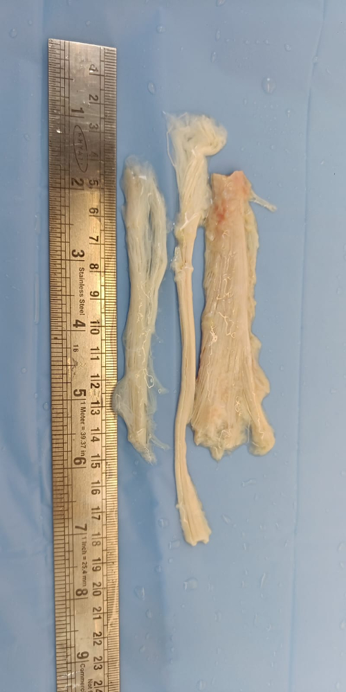 Tendon - TN254